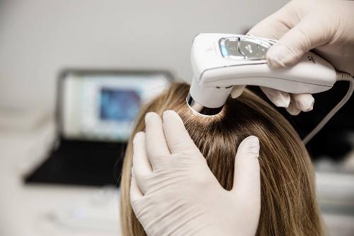Консультация врача дерматолога-трихолога с компьютерной диагностикой (трихоскопией) и процедуры, рекомендованные для лечения волос и кожи головы по специальной цене