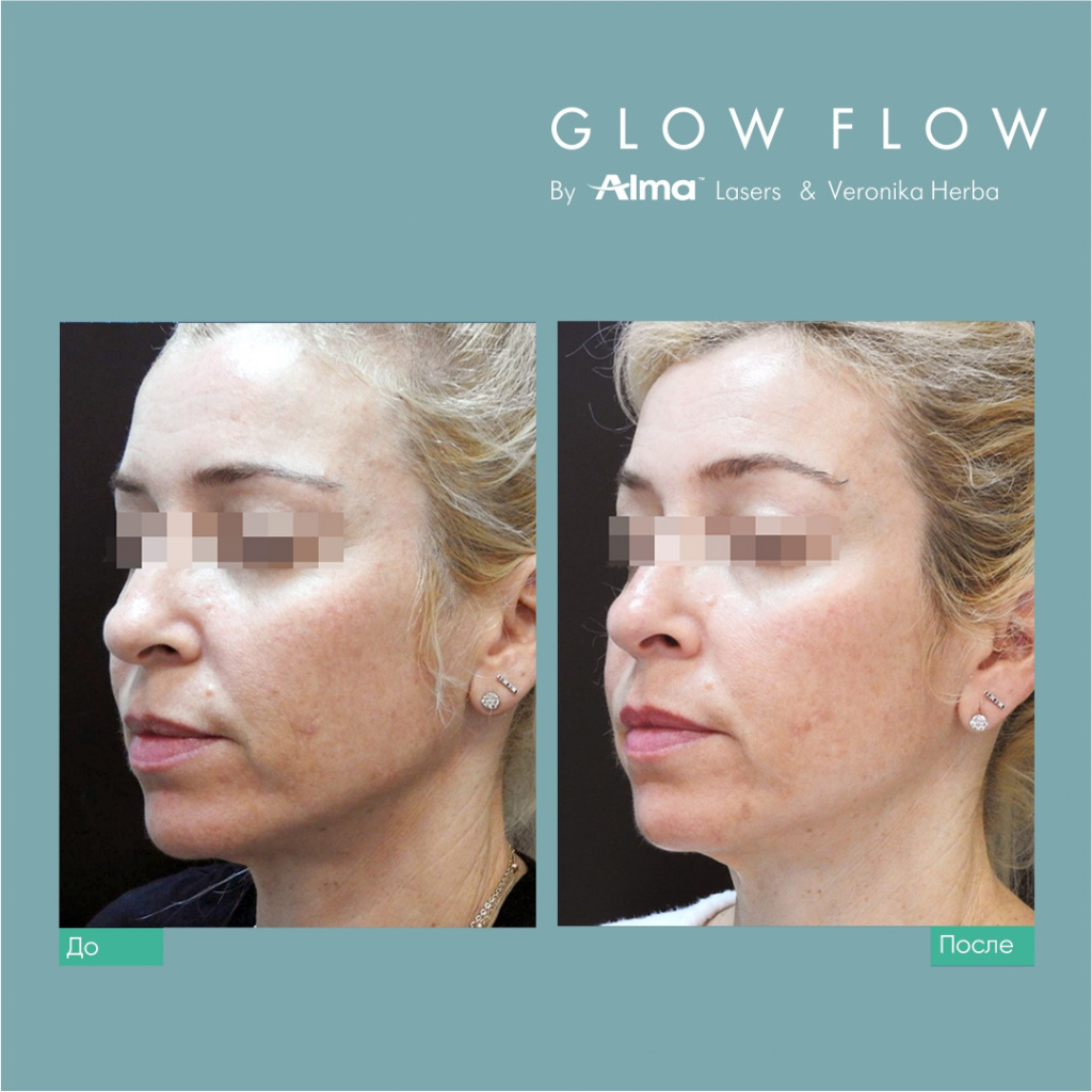 Программа светового восстановления кожи GLOW FLOW